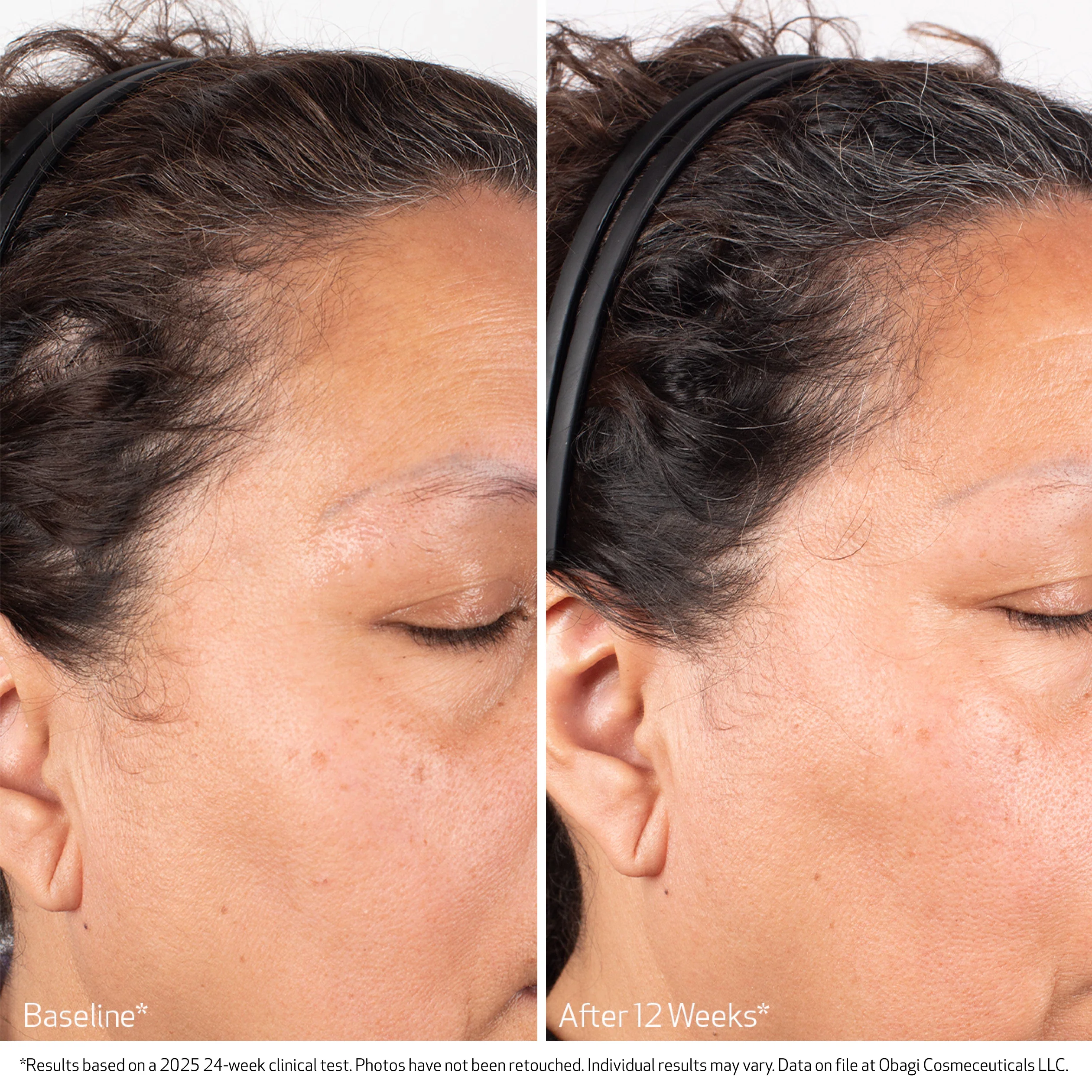 BIOSTIM™ SCALP SERUM - Image 5