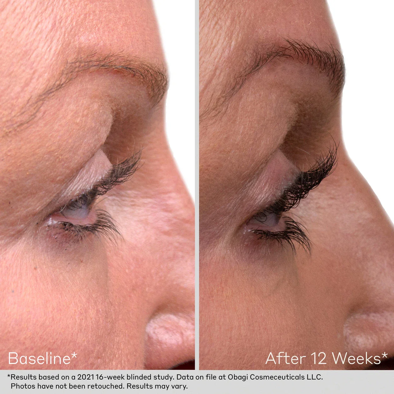 OBAGI® LASH AND BROW SERUM SET - Image 3