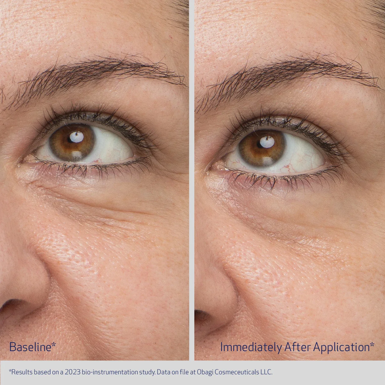 REJUVENATING EYE GEL CREAM - Image 3