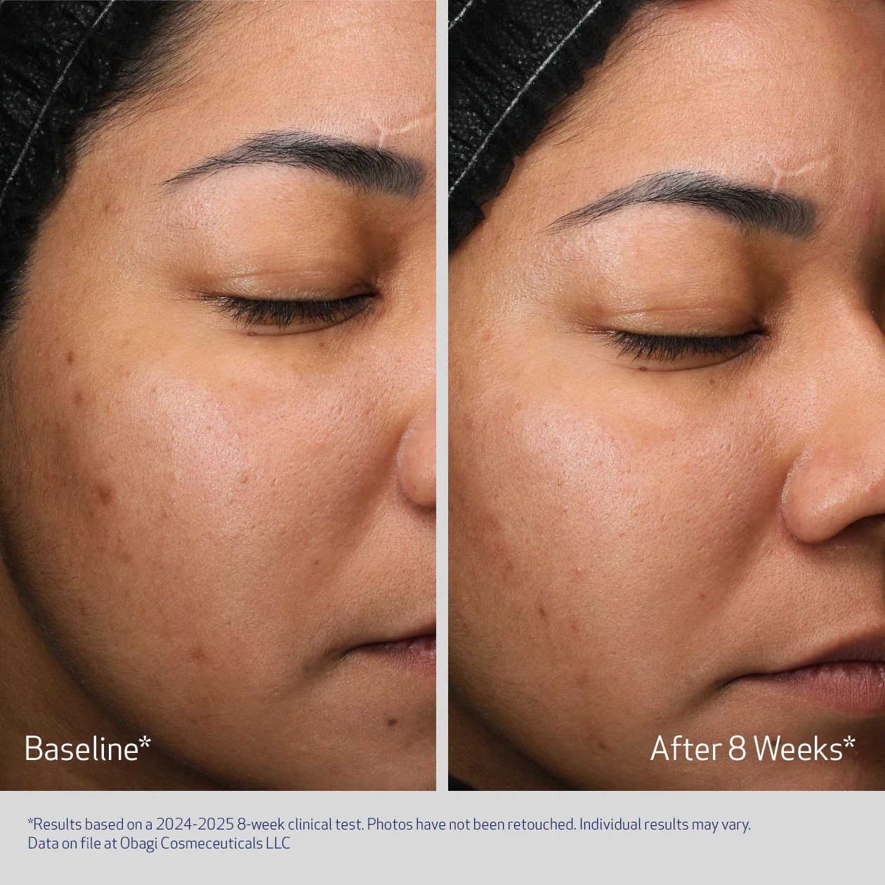 RETINOL + PHA - Image 4